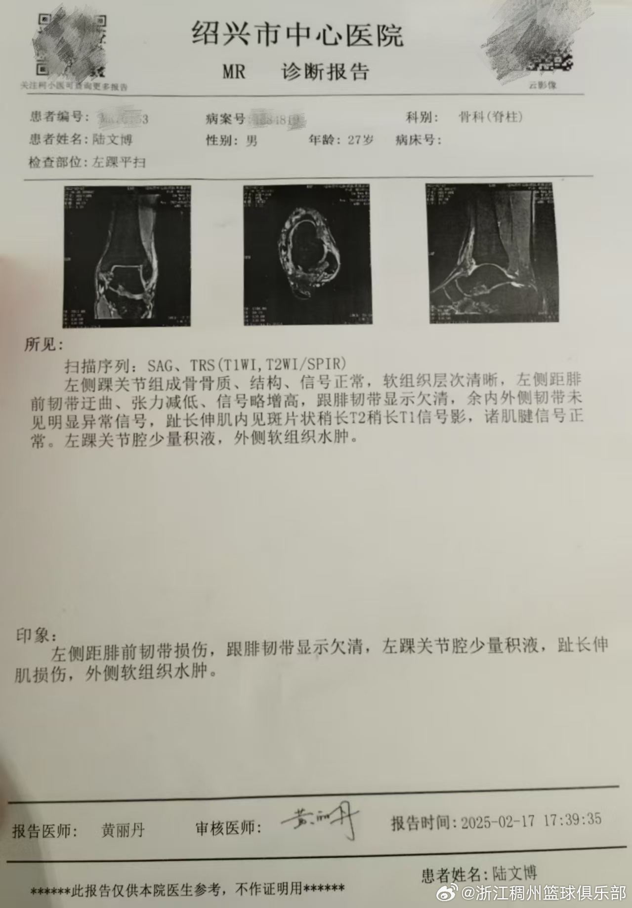 也是广大羽